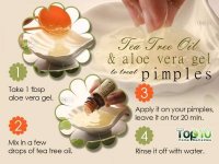 Acne-Tea-Tree-oil-Aloe-vera-gel-600x450.jpg