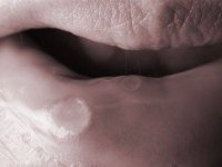 09-men-cancer-signs-mouth-sore-sl.jpg